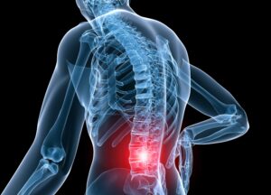 Not All Low Back Pain is a Disc Herniation